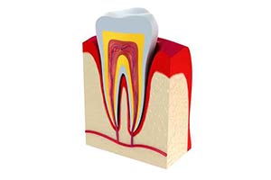 Root Canal in Ann Arbor, MI